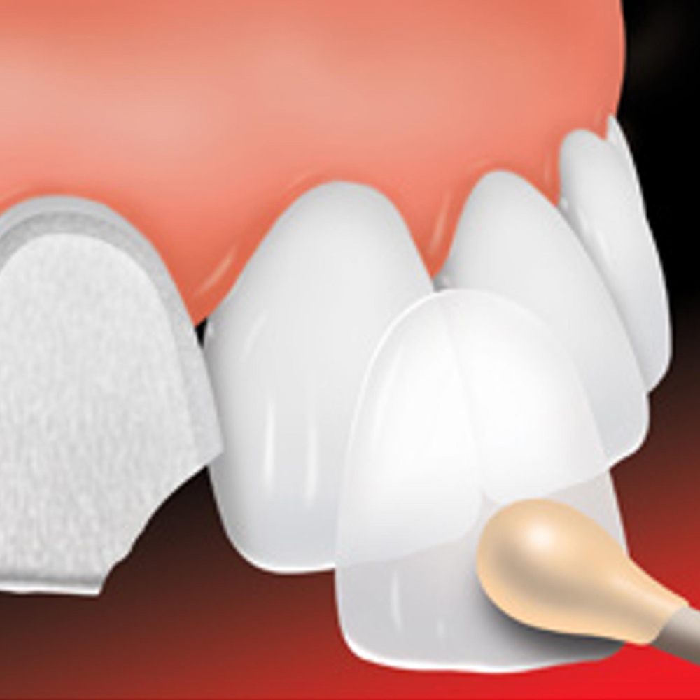 Estetica dentale - studio dentistico Di Conza Foggia