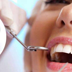 Odontoiatria Conservativa - Studio dentistico Di Conza - Foggia