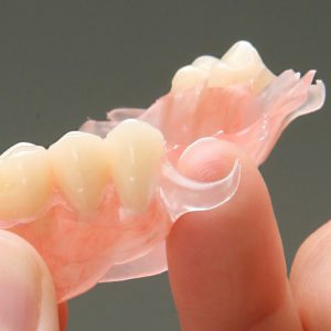 Protesi Dentaria mobile o fissa