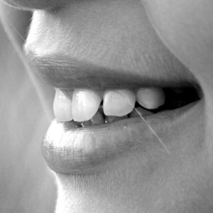 Bruxismo o digrignamento denti: cause, cura e prevenzione