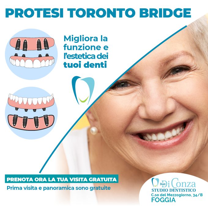 Protesi Toronto Bridge