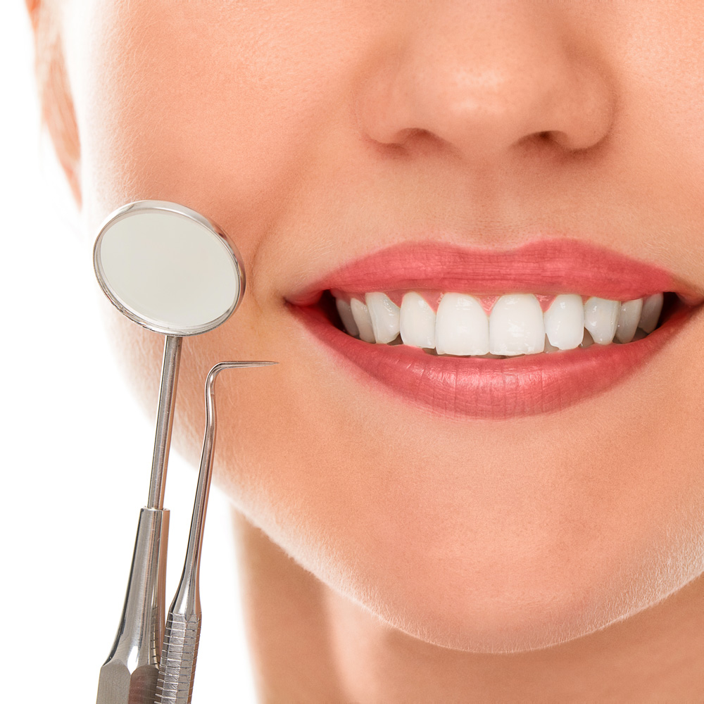 Igiene Dentale Profonda e Ablazione del Tartaro